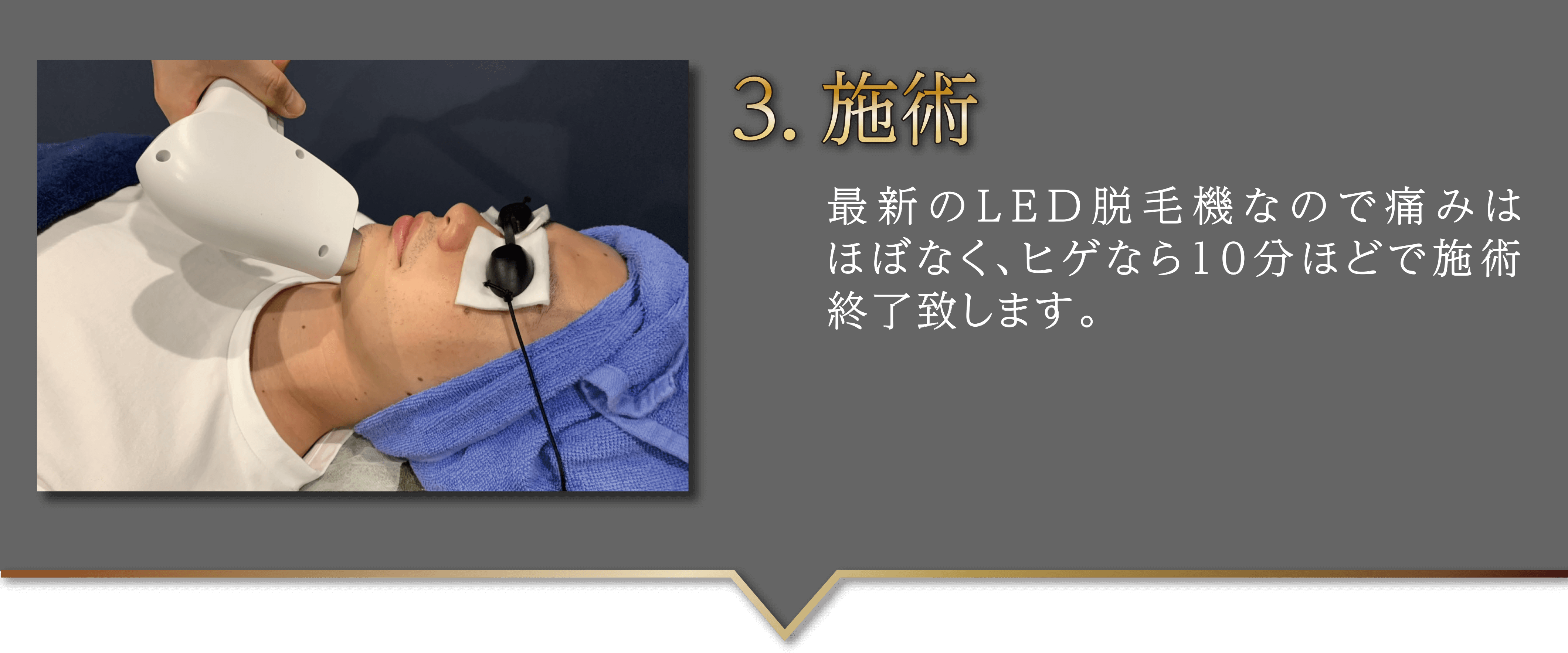 3施術